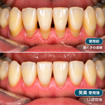 使用前と笑美使用後（12週間後）の比較