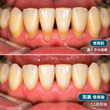 使用前と笑美使用後（12週間後）の比較