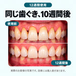 同じ歯ぐき、10週間後